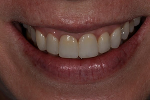 Replacement of Existing Dentistry - Charlotte, NC