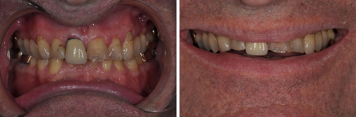 Comprehensive Rehabilitation Case #2 - Before