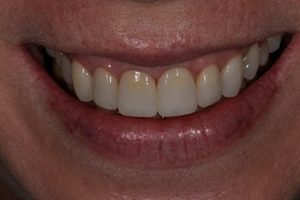 Replacement of Existing Dentistry - Charlotte, NC